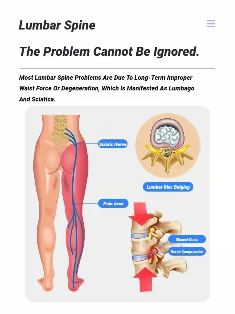 MINOLL Lumbar Back Stretcher for Spine & Pain Relief
